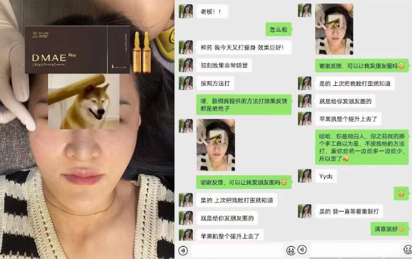 西班牙帝美妮面部提升王 西班牙帝美妮面部提升王